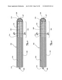 Guidewire diagram and image