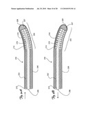 Guidewire diagram and image