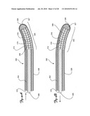 Guidewire diagram and image