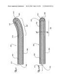 Guidewire diagram and image