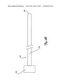 Guidewire diagram and image