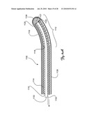 Guidewire diagram and image