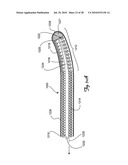 Guidewire diagram and image