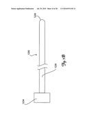 Guidewire diagram and image