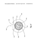 Guidewire diagram and image