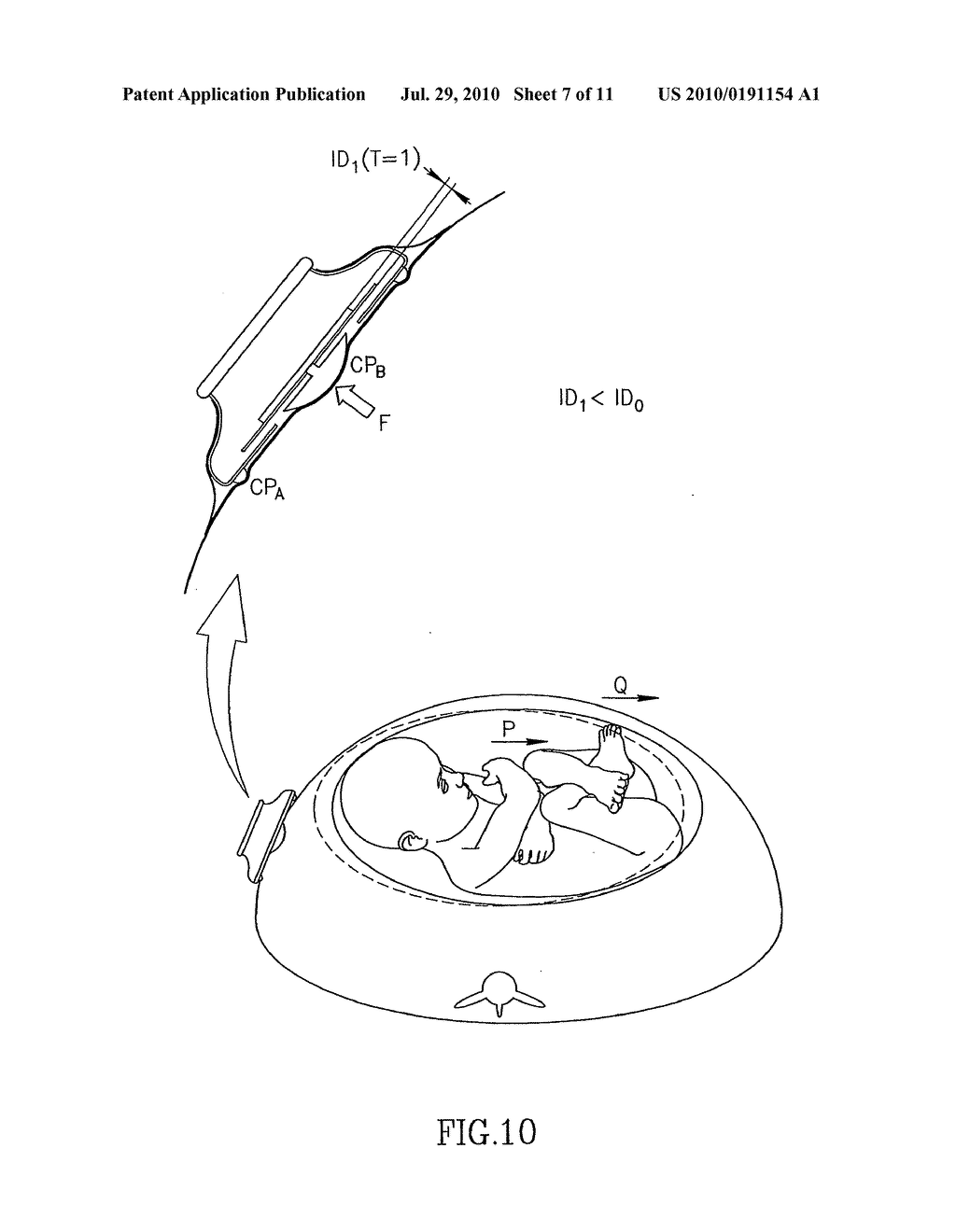 FETAL WELLBEING MONITORING APPARATUS AND PAD THEREFOR - diagram, schematic, and image 08