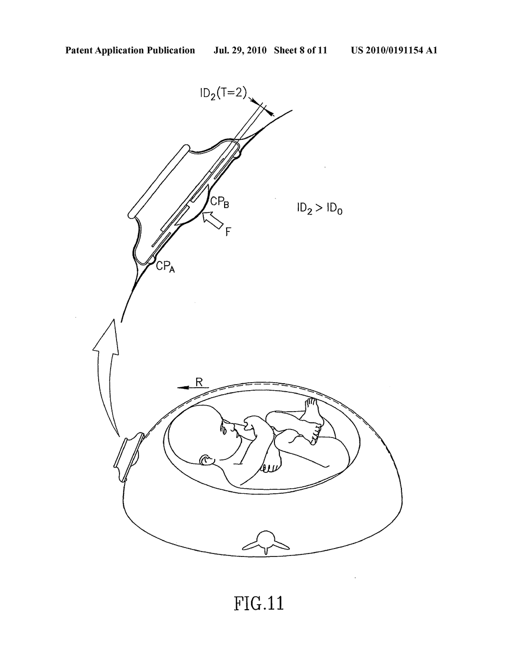 FETAL WELLBEING MONITORING APPARATUS AND PAD THEREFOR - diagram, schematic, and image 09