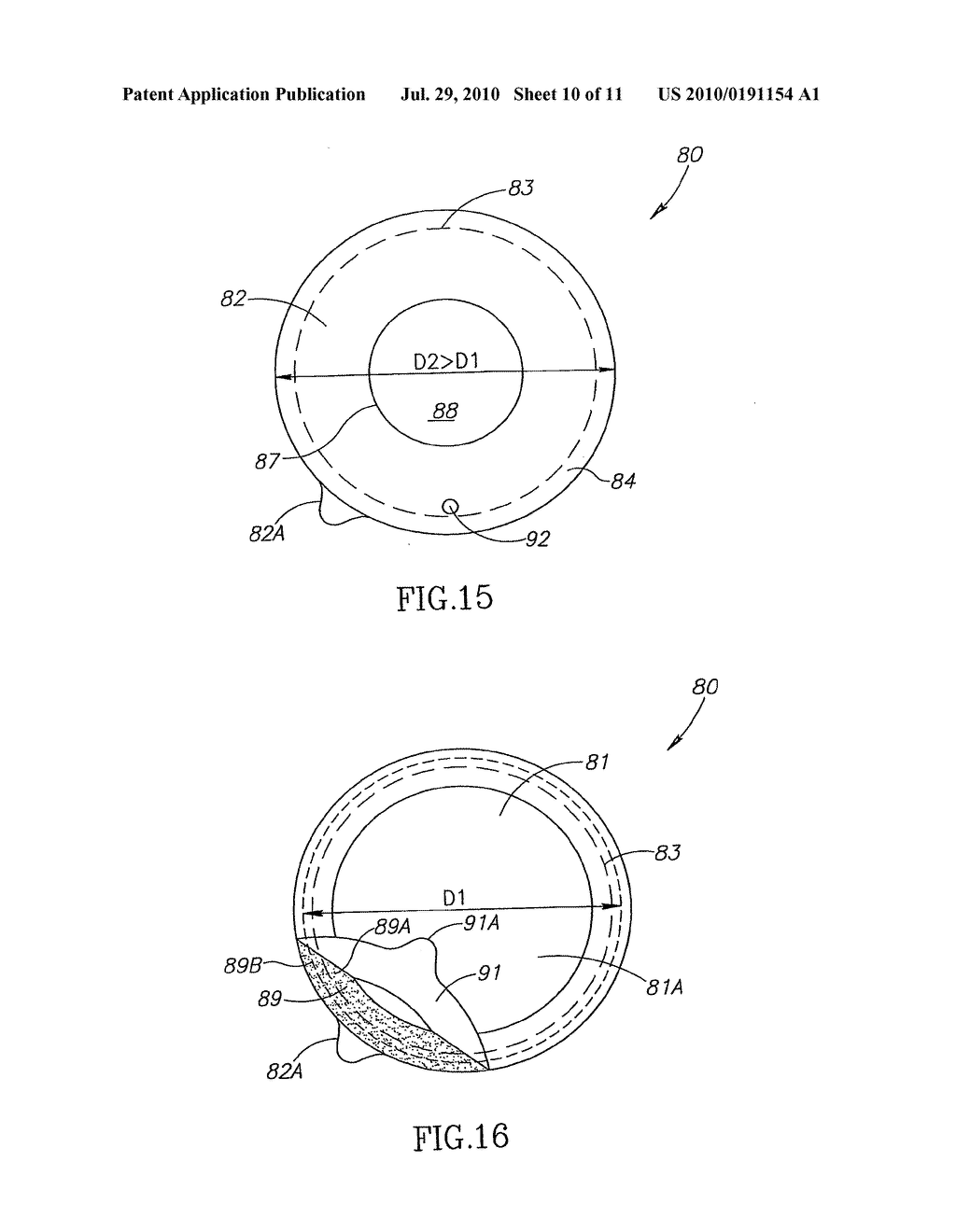 FETAL WELLBEING MONITORING APPARATUS AND PAD THEREFOR - diagram, schematic, and image 11