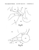 EXERCISE APPARATUS diagram and image