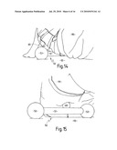 EXERCISE APPARATUS diagram and image