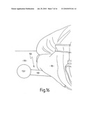 EXERCISE APPARATUS diagram and image