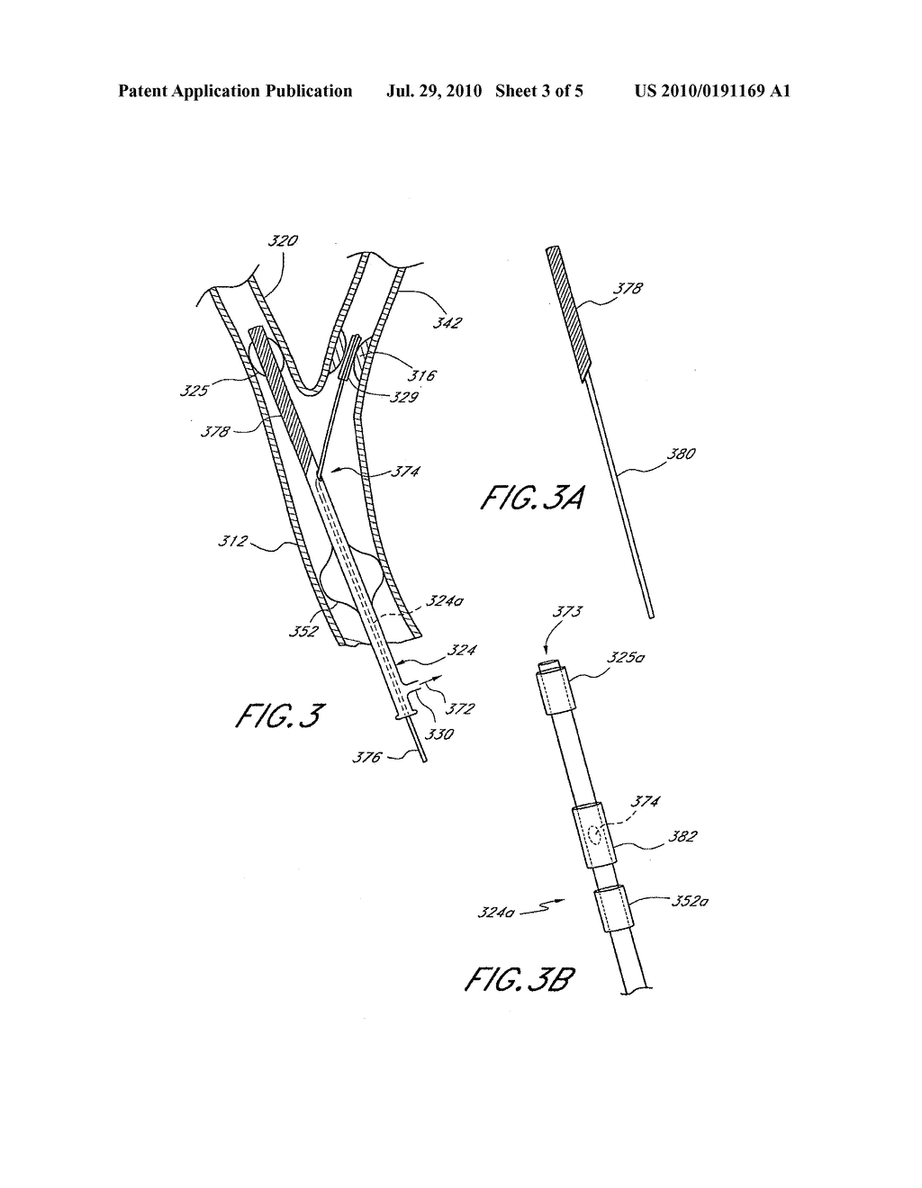 METHOD AND APPARATUS FOR TREATING A CAROTID ARTERY - diagram, schematic, and image 04