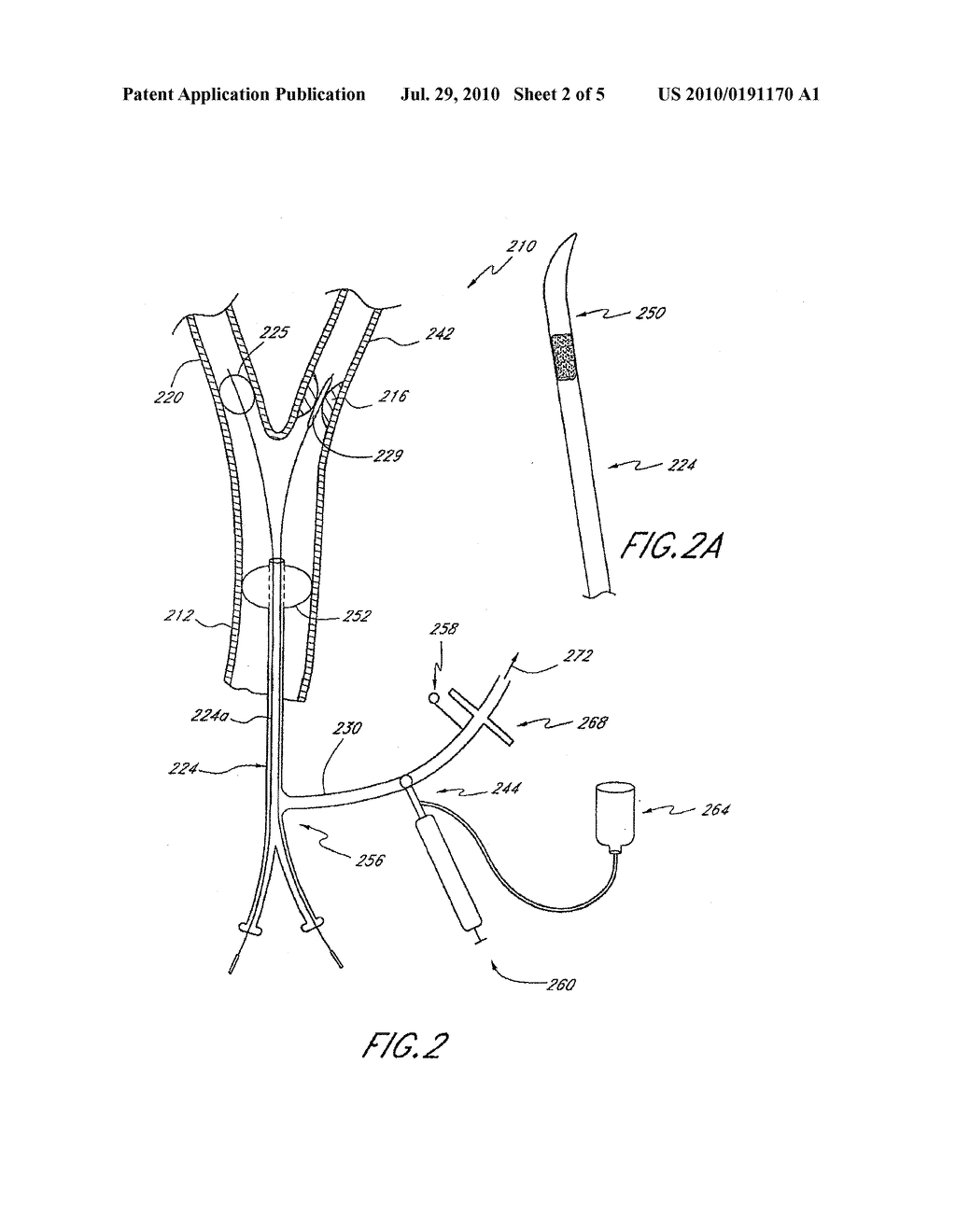 METHOD AND APPARATUS FOR TREATING A CAROTID ARTERY - diagram, schematic, and image 03