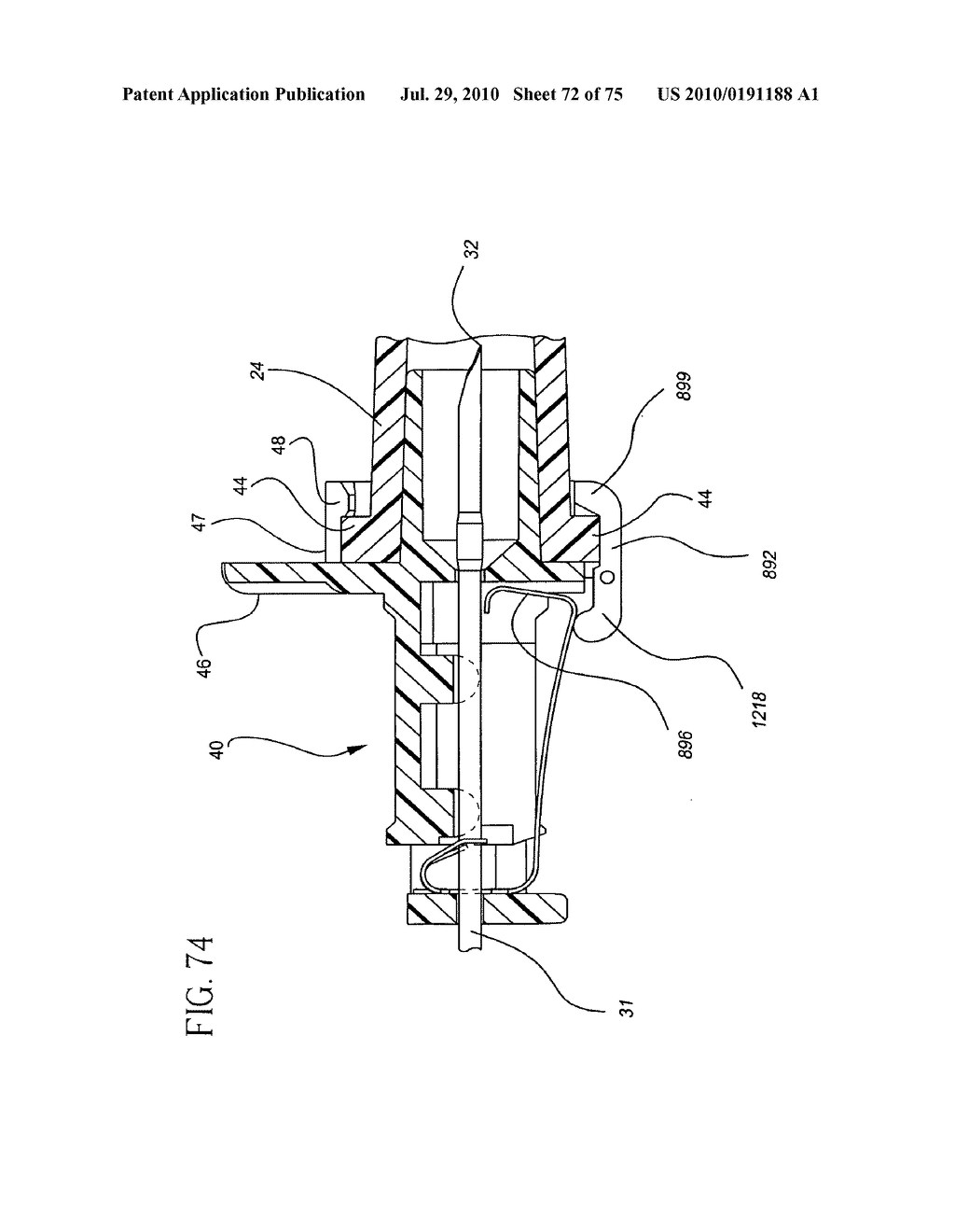 Catheter and Introducer Needle Assembly with Needle Shield - diagram, schematic, and image 73