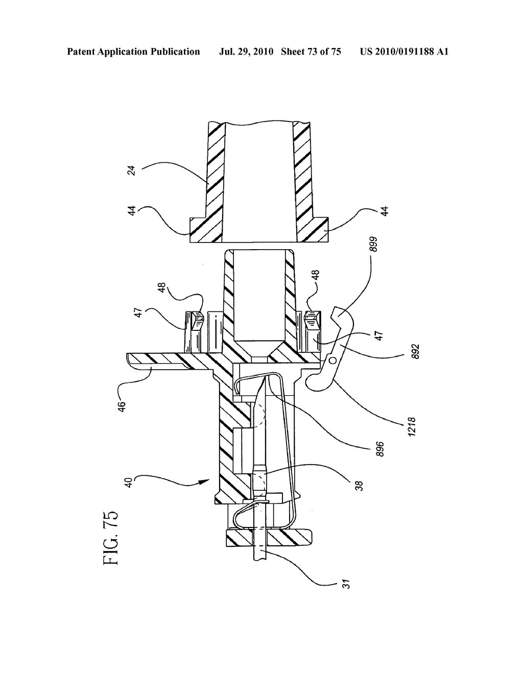 Catheter and Introducer Needle Assembly with Needle Shield - diagram, schematic, and image 74