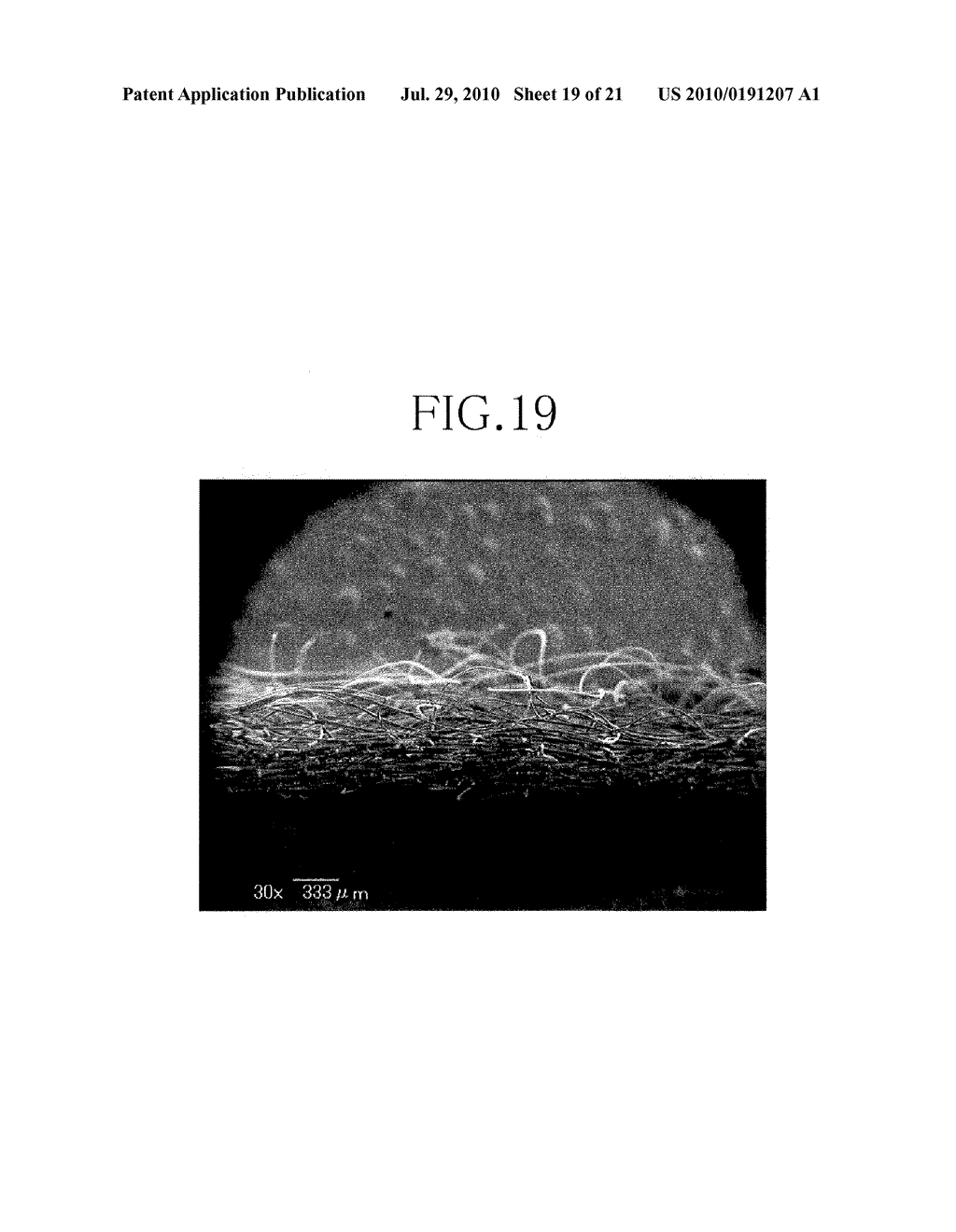 NONWOVEN FABRIC AND METHOD FOR MAKING THE SAME - diagram, schematic, and image 20