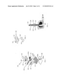 INDICATIONS FOR LOCAL TRANSPORT OF ANAESTHETIC AGENTS BY ELECTROTRANSPORT DEVICES diagram and image