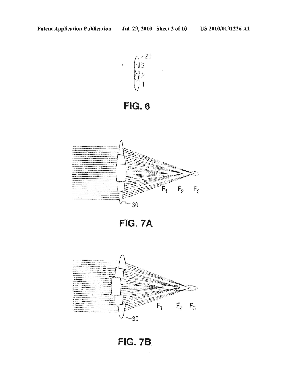 Method Of Patterned Plasma-Mediated Laser Trephination Of The Lens Capsule And Three Dimensional Phaco-Segmentation - diagram, schematic, and image 04