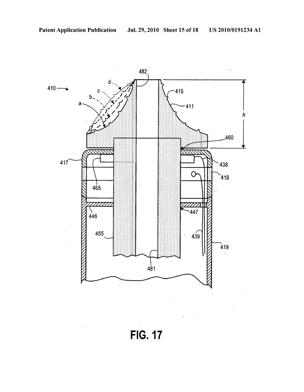 Combination Tissue Removal and Cauterization Instrument - diagram, schematic, and image 16