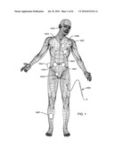 SWITCHED DIVERTER CIRCUITS FOR MINIMIZING HEATING OF AN IMPLANTED LEAD AND/OR PROVIDING EMI PROTECTION IN A HIGH POWER ELECTROMAGNETIC FIELD ENVIRONMENT diagram and image