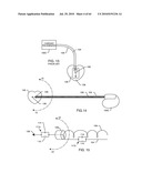 SWITCHED DIVERTER CIRCUITS FOR MINIMIZING HEATING OF AN IMPLANTED LEAD AND/OR PROVIDING EMI PROTECTION IN A HIGH POWER ELECTROMAGNETIC FIELD ENVIRONMENT diagram and image