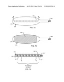 SWITCHED DIVERTER CIRCUITS FOR MINIMIZING HEATING OF AN IMPLANTED LEAD AND/OR PROVIDING EMI PROTECTION IN A HIGH POWER ELECTROMAGNETIC FIELD ENVIRONMENT diagram and image