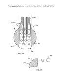 SWITCHED DIVERTER CIRCUITS FOR MINIMIZING HEATING OF AN IMPLANTED LEAD AND/OR PROVIDING EMI PROTECTION IN A HIGH POWER ELECTROMAGNETIC FIELD ENVIRONMENT diagram and image