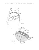 SWITCHED DIVERTER CIRCUITS FOR MINIMIZING HEATING OF AN IMPLANTED LEAD AND/OR PROVIDING EMI PROTECTION IN A HIGH POWER ELECTROMAGNETIC FIELD ENVIRONMENT diagram and image