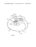 SWITCHED DIVERTER CIRCUITS FOR MINIMIZING HEATING OF AN IMPLANTED LEAD AND/OR PROVIDING EMI PROTECTION IN A HIGH POWER ELECTROMAGNETIC FIELD ENVIRONMENT diagram and image