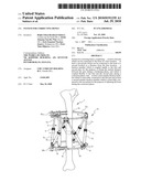 System for Correcting Bones diagram and image