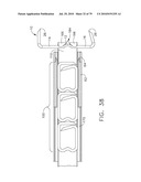 Method for Applying A Surgical Staple diagram and image