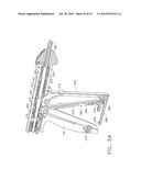 Method for Applying A Surgical Staple diagram and image