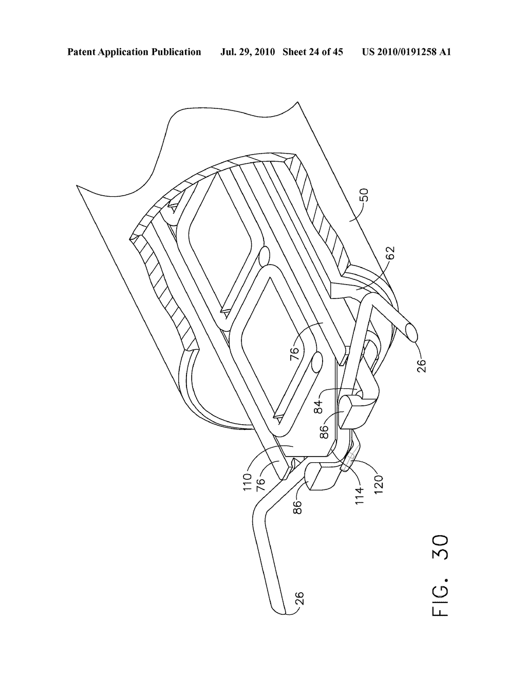  SURGICAL STAPLER FOR APPLYING A LARGE STAPLE THROUGH A SMALL DELIVERY PORT AND A METHOD OF USING THE STAPLER TO SECURE A TISSUE FOLD - diagram, schematic, and image 25