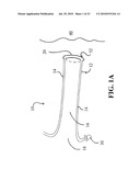 DEVICES, SYSTEMS AND METHODS FOR DIAGNOSING AND DELIVERING THERAPEUTIC INTERVENTIONS IN THE PERITONEAL CAVITY diagram and image