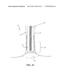 DEVICES, SYSTEMS AND METHODS FOR DIAGNOSING AND DELIVERING THERAPEUTIC INTERVENTIONS IN THE PERITONEAL CAVITY diagram and image