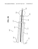 DEVICES, SYSTEMS AND METHODS FOR DIAGNOSING AND DELIVERING THERAPEUTIC INTERVENTIONS IN THE PERITONEAL CAVITY diagram and image