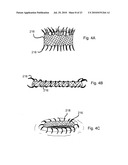 DEVICES, SYSTEMS AND METHODS FOR DIAGNOSING AND DELIVERING THERAPEUTIC INTERVENTIONS IN THE PERITONEAL CAVITY diagram and image