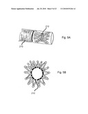 DEVICES, SYSTEMS AND METHODS FOR DIAGNOSING AND DELIVERING THERAPEUTIC INTERVENTIONS IN THE PERITONEAL CAVITY diagram and image