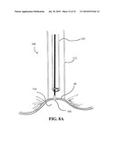 DEVICES, SYSTEMS AND METHODS FOR DIAGNOSING AND DELIVERING THERAPEUTIC INTERVENTIONS IN THE PERITONEAL CAVITY diagram and image