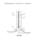 DEVICES, SYSTEMS AND METHODS FOR DIAGNOSING AND DELIVERING THERAPEUTIC INTERVENTIONS IN THE PERITONEAL CAVITY diagram and image