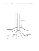 DEVICES, SYSTEMS AND METHODS FOR DIAGNOSING AND DELIVERING THERAPEUTIC INTERVENTIONS IN THE PERITONEAL CAVITY diagram and image