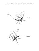 DEVICES, SYSTEMS AND METHODS FOR DIAGNOSING AND DELIVERING THERAPEUTIC INTERVENTIONS IN THE PERITONEAL CAVITY diagram and image