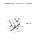 DEVICES, SYSTEMS AND METHODS FOR DIAGNOSING AND DELIVERING THERAPEUTIC INTERVENTIONS IN THE PERITONEAL CAVITY diagram and image