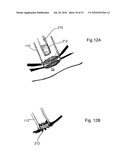 DEVICES, SYSTEMS AND METHODS FOR DIAGNOSING AND DELIVERING THERAPEUTIC INTERVENTIONS IN THE PERITONEAL CAVITY diagram and image