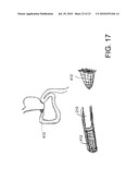 DEVICES, SYSTEMS AND METHODS FOR DIAGNOSING AND DELIVERING THERAPEUTIC INTERVENTIONS IN THE PERITONEAL CAVITY diagram and image