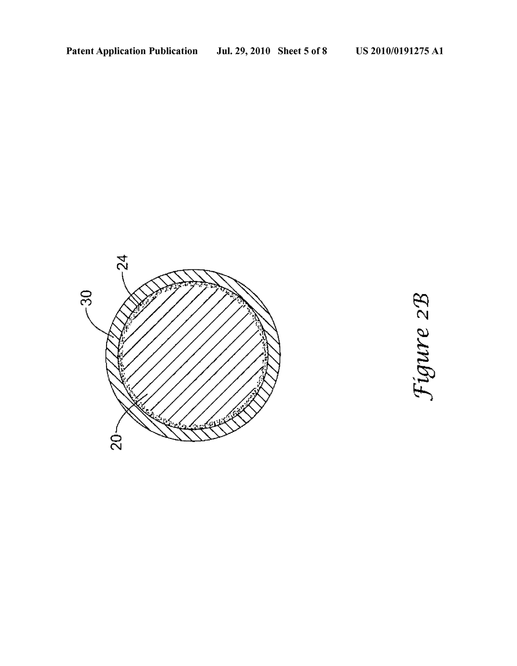 FILTER DEPLOYMENT DEVICE - diagram, schematic, and image 06