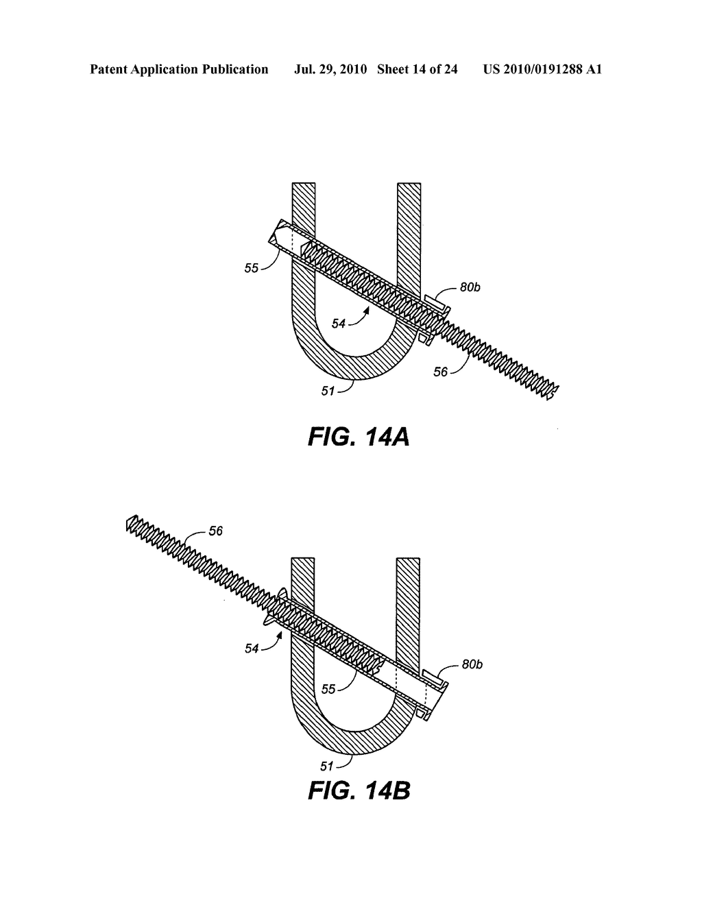 ADJUSTABLE SPINAL IMPLANT DEVICE AND METHOD - diagram, schematic, and image 15