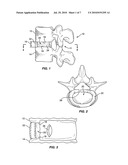 ANNULUS REPAIR SYSTEM diagram and image