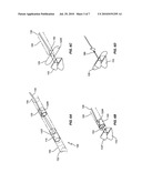 ANNULUS REPAIR SYSTEM diagram and image