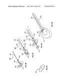 ANNULUS REPAIR SYSTEM diagram and image